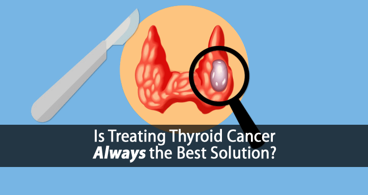 Thyroid Cancer Treatment 3 Reasons You Shouldn't Always