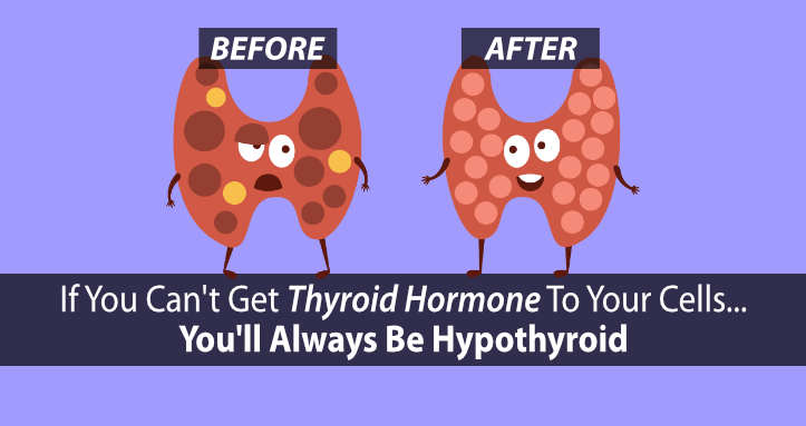 hypothyroidism