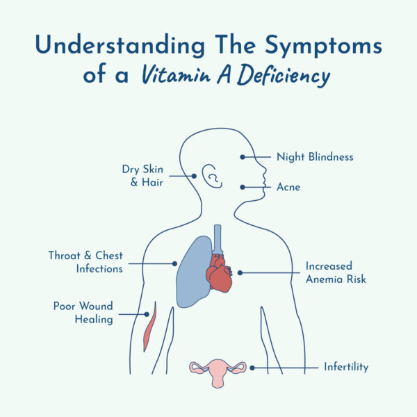 Graphic showing symptoms of Vitamin A deficiency